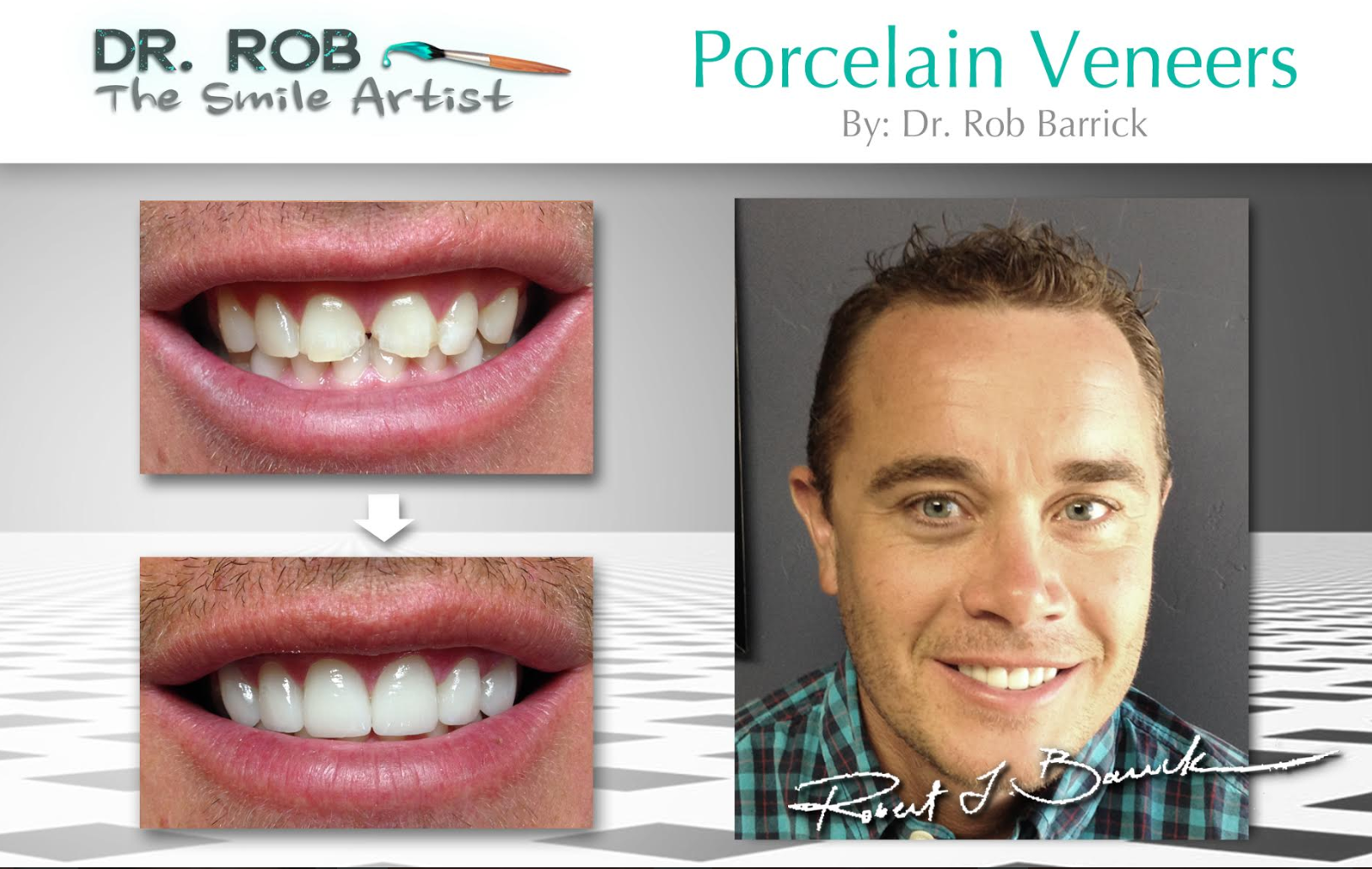 Before and after cosmetic dentistry — natural smile restoration in Cedar City