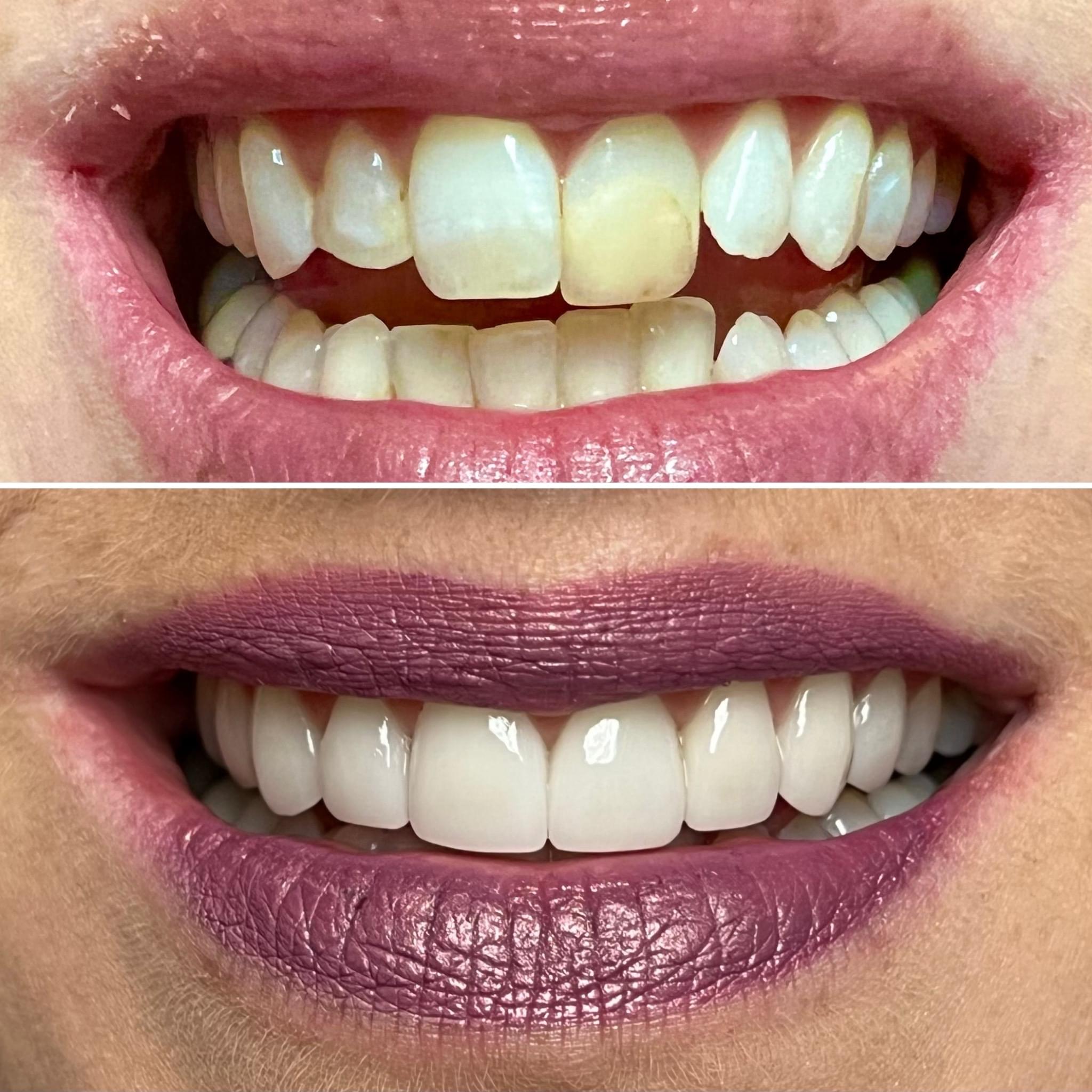 Happy patient showing off new smile after cosmetic dental treatment